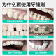 Meyarn interdental cepillo L en forma de L 20 mm 20 piezas, cerdas suaves, alambre de acero importado de corrección de dientes de corrección de ortodoncia