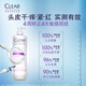 清扬（CLEAR）头皮学专研舒缓修护洗发水300G紫C瓶 止痒舒缓胖东来罗云熙同款