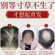
Nanjing Tongrentang Ginger Prevention and Developing Shampoo for Hair Resilience and Long Hair Loss and Oil Control Herbal Shampoo for Men and Women 400ml 1 Bottle 400ml [Minor Hair Loss]