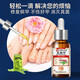 The No. 1 onychomycosis effect in Hong Kong Pharmacy, special nail fungus infection, yellowing and thickening of onychomycosis, impatiens antibacterial liquid, 2-5 onychomycosis, highly recommended, 69% people choose 3 boxes