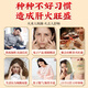 Peking Tongrentang Chrysanthemen Wolfberry Cassia Teer Löwenzahn Tee Nourishes Leberschutz Tee Geißblatt Tee Aufenthalt spät, um das Sehvermögen zu verbessern, Feuer und Entgiftung Tee zu entfernen [Foto 1 Schuss 3 Kisten] Die Leber schützen und die Nieren schützen