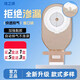 一件式造口袋肠改道造瘘大便袋肠癌罩口袋造瘘袋肛肠造漏袋 买1盒2个共12个]9901基础夹子