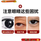 The official flagship of the ancient and modern inverted eyelash patch for children and infants, the magic tool for lower eyelid trichiasis ectropion and lifting, 3 boxes of treatment packages for severe inability to open eyelashes inverted, Fat Donglai online supermarket