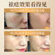 Dr. Mo's Hong Kong Pharmacy Mole Spot and Mole Removal Cream, No Scars on the Face, Black Mole Painless Repair Solution, Available for Children