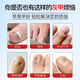 Tongrentang Onychomycosis Special Nail Fungus Infection Removal, Bad Nails, Bright Nails, Onychomycosis, Net Yellowing, Thickening and Empty 30ml