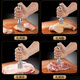 Heqing 304 acier inoxydable viande desserrage aiguille cuisine ménage viande frapper marteau steak outil de poinçonnage outil de perçage de viande briser tendon attendrisseur aiguille ronde mini 9 aiguille 304 acier inoxydable