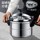 Big brand pressure cooker commercial gas induction cooker universal pressure cooker household explosion-proof safety large capacity 20 gas open flame model 20cm 4L