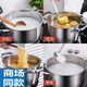 SUPOR's same model 316 extra thick food-grade stainless steel soup pot for household stew, porridge pot, hot pot, steamer, gas stove, electric, comes with advanced interior viewable explosion-proof cover cm 26cm