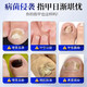Layanana special effect on onychomycosis, special use of yellowing and thickening root cream to treat nail infection, removal of onychomycosis and bactericidal liquid cream 30ml