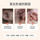 ERGOBABY pet cat ear mites dog ear drops otitis fungi ear drop ear medicine ear smell itching sucking sucking swelling 20ml