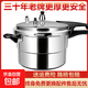 Pressure cooker household explosion-proof gas open flame gas pressure cooker thickened commercial large capacity optional induction cooker universal gas induction cooker universal for 2-5 people 22cm 5L