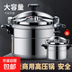 Big brand pressure cooker commercial gas induction cooker universal pressure cooker household explosion-proof safety large capacity 20 gas open flame model 20cm 4L