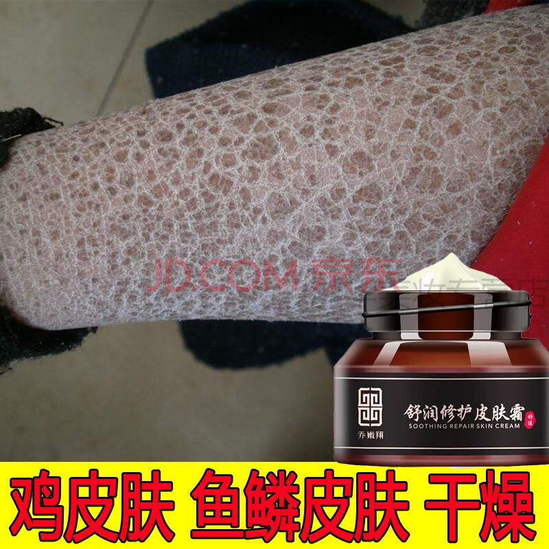 有疙瘩的鸡皮肤图片和名称(有疙瘩的鸡皮肤图片和名称图)