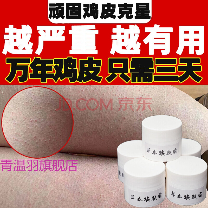 挑鸡皮肤里的毛(鸡毛皮肤是什么原因) 挑鸡皮肤里的毛(鸡毛皮肤是什么原因)