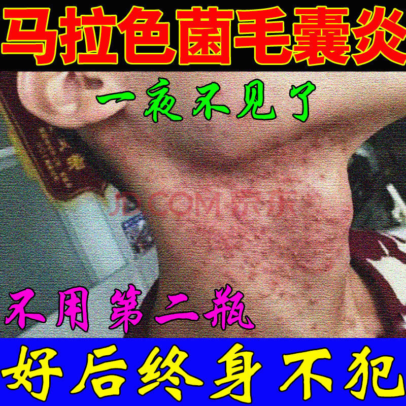 关于宝拉珍选身体乳毛囊炎的信息