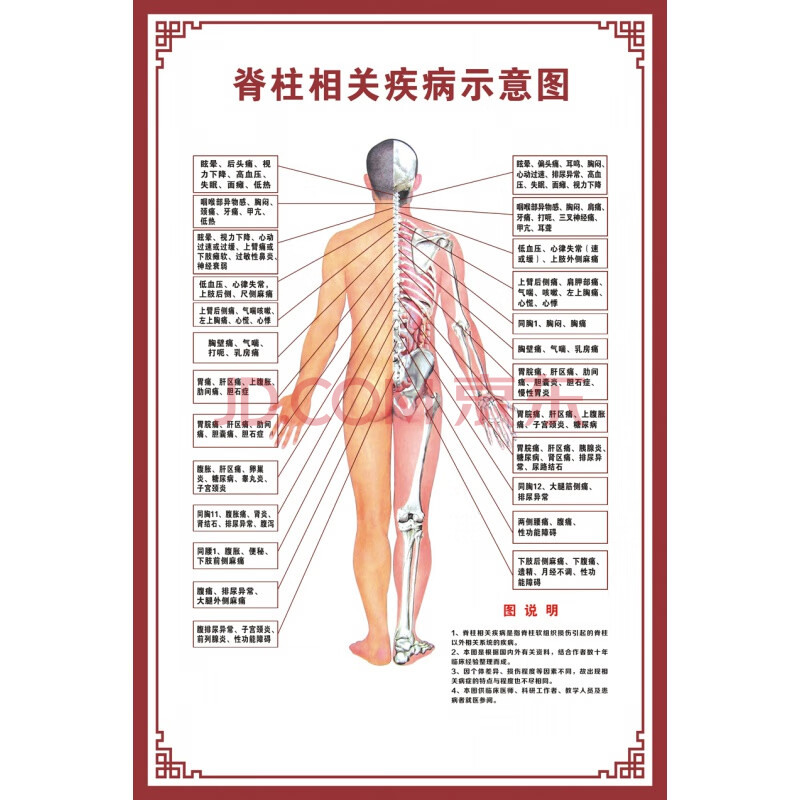 脊柱相關疾病人體脊椎全息圖健康速查表美容院裝飾畫中醫館掛圖 脊柱