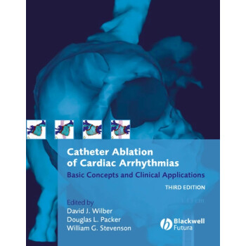 Catheter Ablation of Cardiac Arrhythmias - Basic Concepts And Clinical Applications 3E