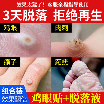 60jd健康60鸡眼膏跖疣专用非膏贴去除足部寻常疣手部拓疣趾疣去