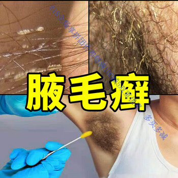 腋毛廯腋下清洗液异味污垢出汗瘙痒晶体白色腋窝毛藓附着物 毛藓附着物【图片 价格 品牌 报价】-京东