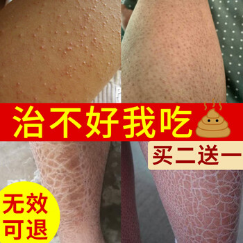 鸡皮肤如何长期保湿(鸡皮肤用什么保湿护肤品好)