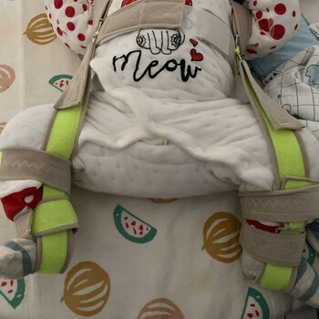 婴儿髋关节固定支具髋关节发育不良矫形器儿童蛙式架髋关节矫形器绿色