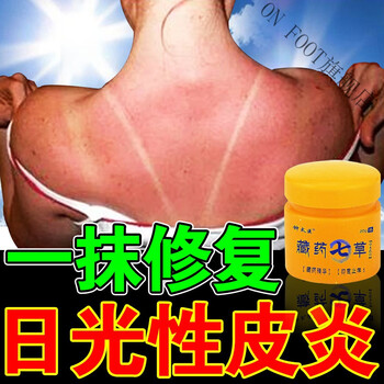 日光性皮l炎软膏除神经性皮l炎治l疗晒伤晒后修复过敏止痒外用箹