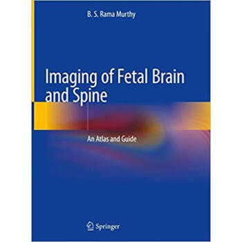 Imaging of Fetal Brain and Spine: An Atlas and G