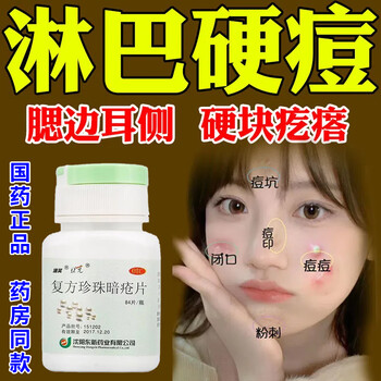 【京东大药房】复方珍珠暗疮片 治淋巴痘 腮边痘祛痘药下巴耳侧硬块
