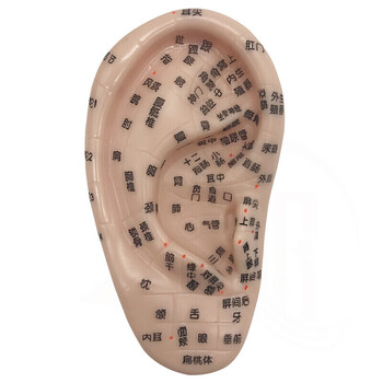 丰帆 耳穴贴王不留行籽贴耳豆贴 耳贴按摩贴耳穴位按压 耳穴压豆 13cm