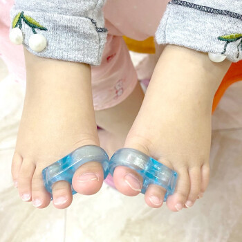 脚趾头小孩大拇指外翻矫正器宝宝重叠分离器分趾大母指内扣835婴儿