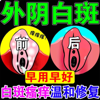 如何确定是外阴白斑图片