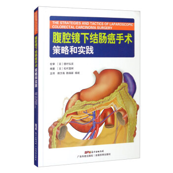 腹腔镜下结肠癌手术策略和实践  [The Strategies and Tactics of Laparoscopic Colorectal Carcinoma Surgery]