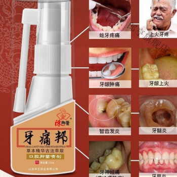 牙l痛邦老牌陳御醫可用消l炎訷器牙神經智齒上火牙齦腫痛噴劑景凡三