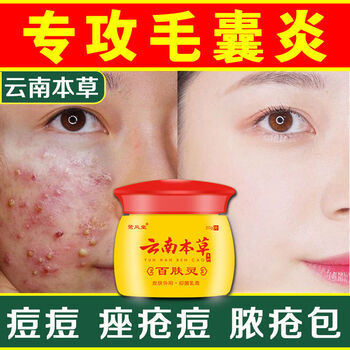性毛囊炎疥螨性毛囊炎云南本草百肤止痒膏1瓶装云南本草系列百肤灵膏