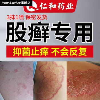 药业大腿内侧瘙痒屁股藓癣膏牛皮肤股1癣软膏皮肤真菌感染牛藓皮黑红