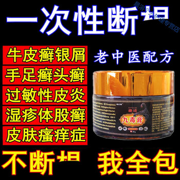 复方黄柏祛l癣搽剂治撩牛皮l癣银i屑病瘙痒止i痒湿l疹去l根除头皮ii癣