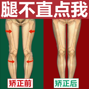 2022新款糾正xo型矯正神器o型腿x型腿xo型腿羅圈腿器男女體態糾正腿型