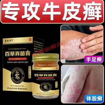 百草膏专用顽固性牛l皮l癣银l屑l病膏皮l炎湿l