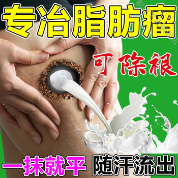 脂肪瘤消散膏消除硬块全身多发性克星中箹皮下专用l箹散结去除訷器买