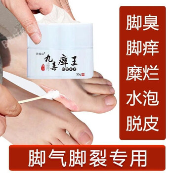 官方旗舰九毒王九毒癣王专用顽固性牛手止痒乳膏买5送49盒大面积装送