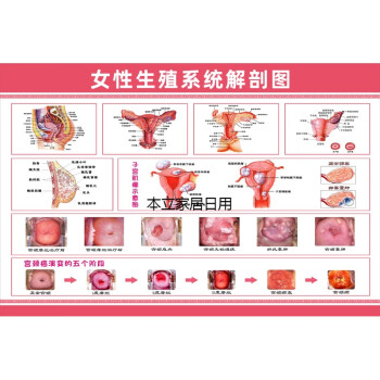 女性生殖器系統解剖圖醫院宣傳畫掛圖子宮婦科海報宮頸疾病示意圖女性