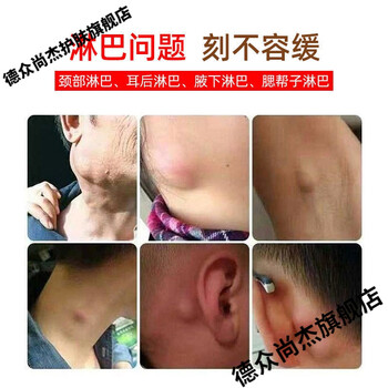 淋巴散结膏颈部耳后腋下硬块红肿热痛1盒6贴装万秋堂淋巴贴一盒优惠装