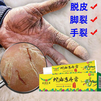强效除冻l疮蛇油冻l疮膏消l肿止痒蛇油膏防冻防裂脚后跟干裂1支体验