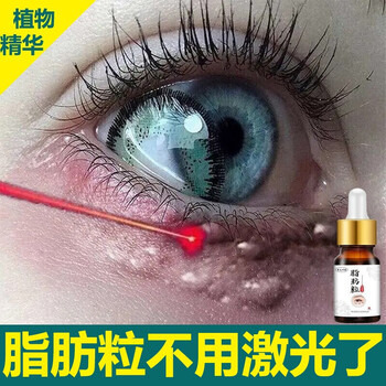 新款草本祛眼部油脂粒脂肪粒汗管瘤眼霜膏脂肪粒淡化黑眼圈袋眼部细纹