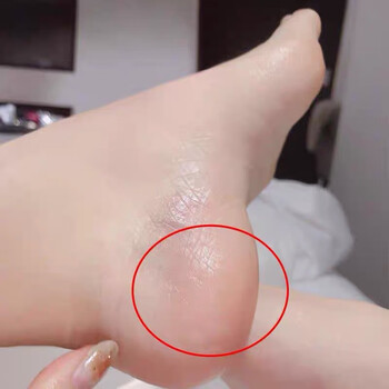 【专攻手脚干裂】进口原料马油膏护手霜皲裂膏冻伤疮膏 预防脚后跟