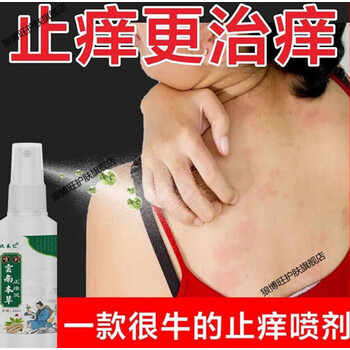 肤立宁喷剂全身皮肤止痒干燥瘙痒蚊虫叮咬方便不油腻外用止痒清香喷雾