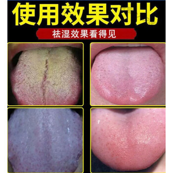 一次祛除不再范舌头白舌苔厚舌头发黄口臭裂纹有异味牙膏买二一285倍