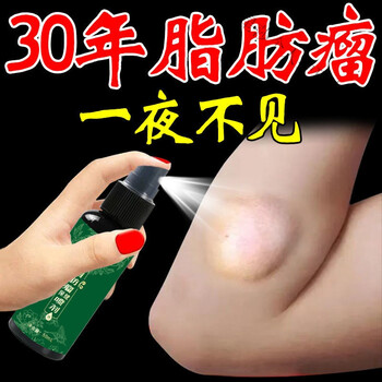 脂肪瘤克星皮肤硬块肿大多发性脂肪瘤肿块囊肿粉瘤一盒体验装