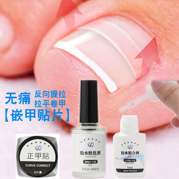 梦多福甲沟炎矫正器正甲贴嵌甲脚指甲刀修脚工