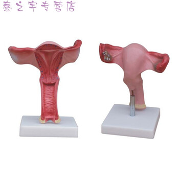 人体模型女性生殖子宫模型卵巢模型教学模具病理变化科普教具 d款